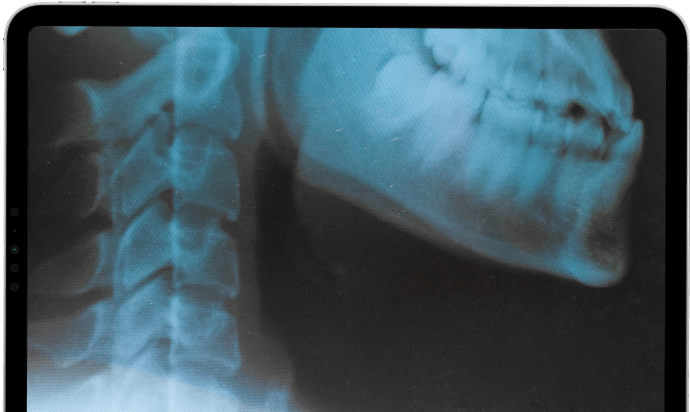 X-ray on iPad